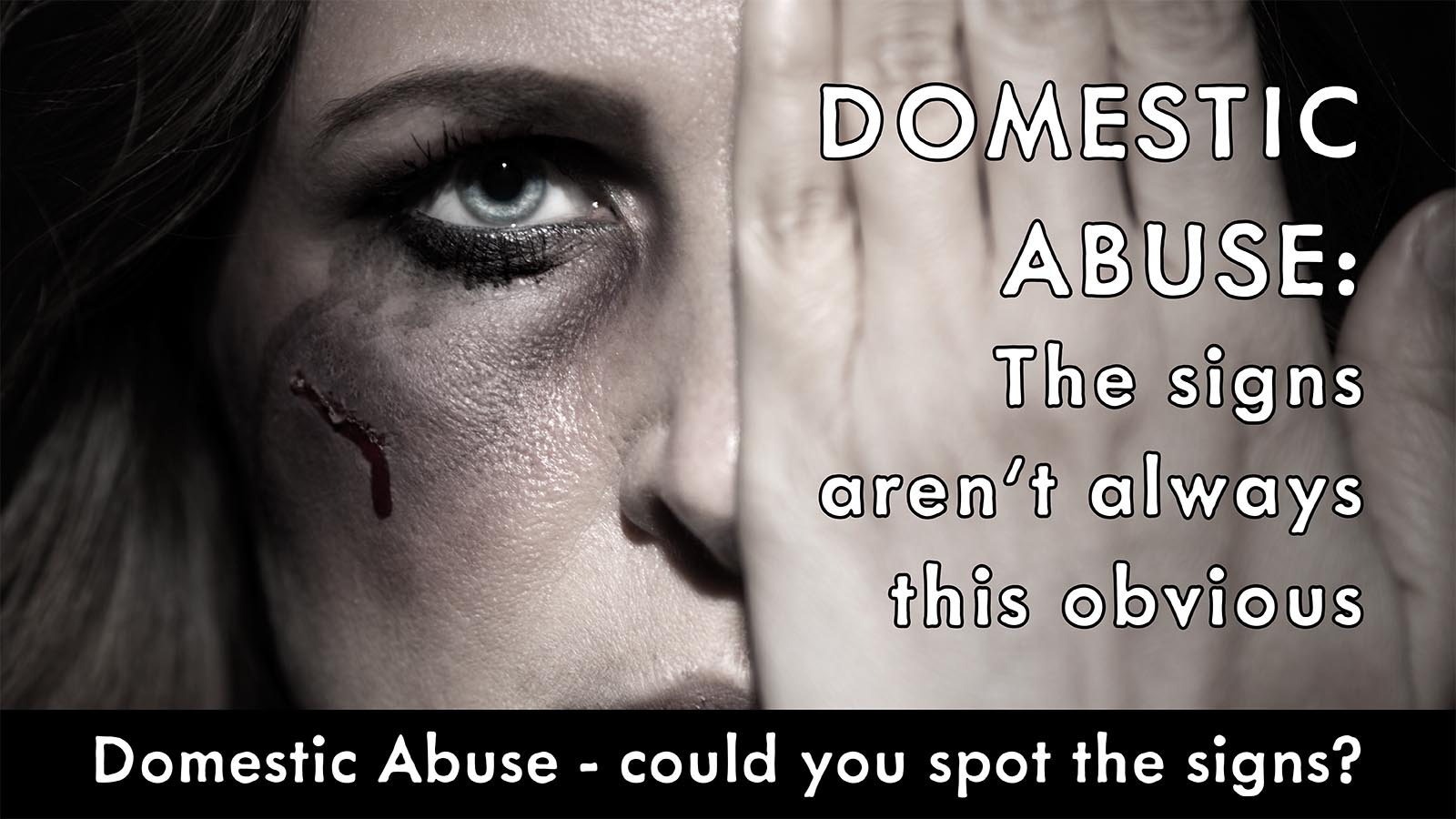 Domestic abuse facial injury 